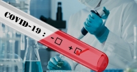 3.227 νέα κρούσματα κορωνοϊού και 59 θάνατοι το τελευταίο 24ωρο στη χώρα